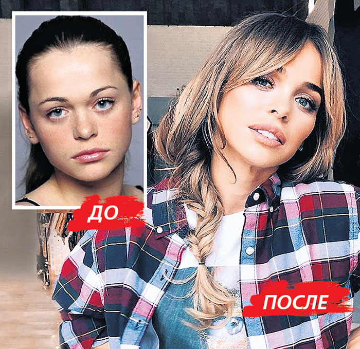 Звезда «Универа» Аня Хилькевич, родив двух дочек, превратила себя в безликую куклу
