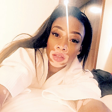 Пятнистая модель...