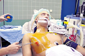 ПОДГОТОВИТЕЛЬНЫЙ ПЕРИОД: йод уничтожает все микробы