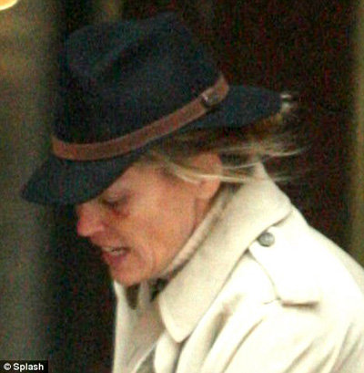 Такие следы обычно остаются после омолаживающих процедур. Фото Daily Mail